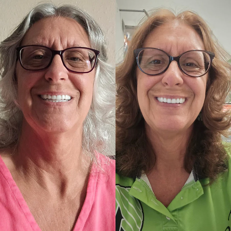 Polar customer result